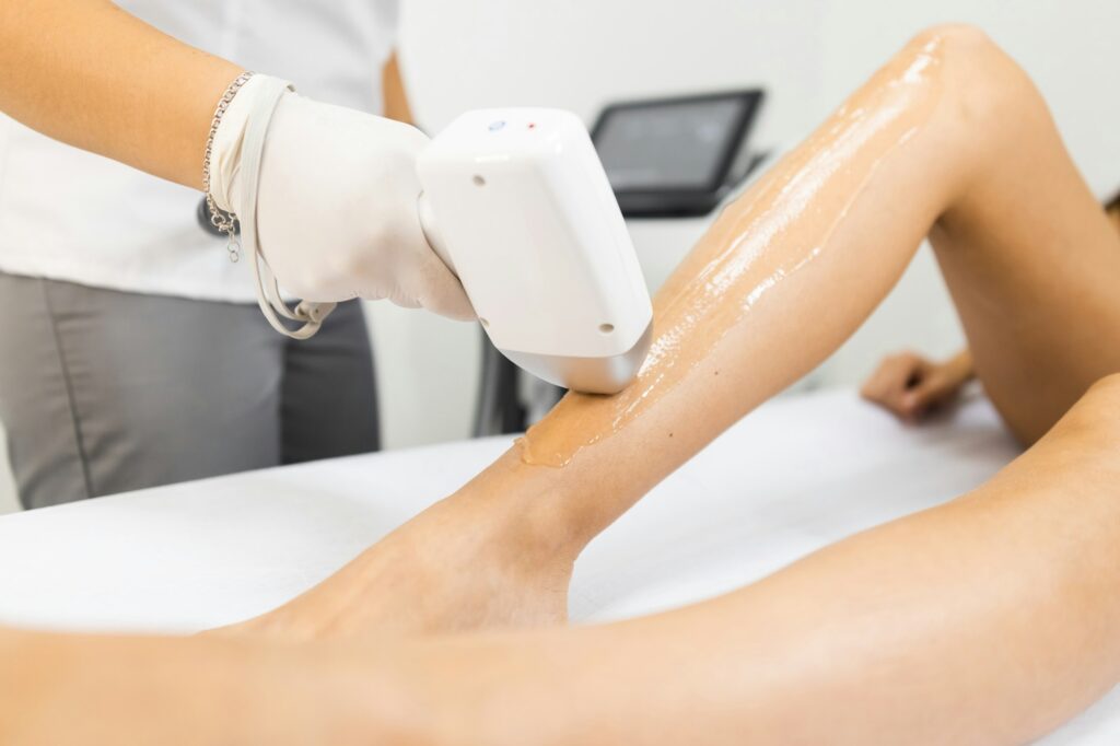 Laser hair removal process for woman's legs