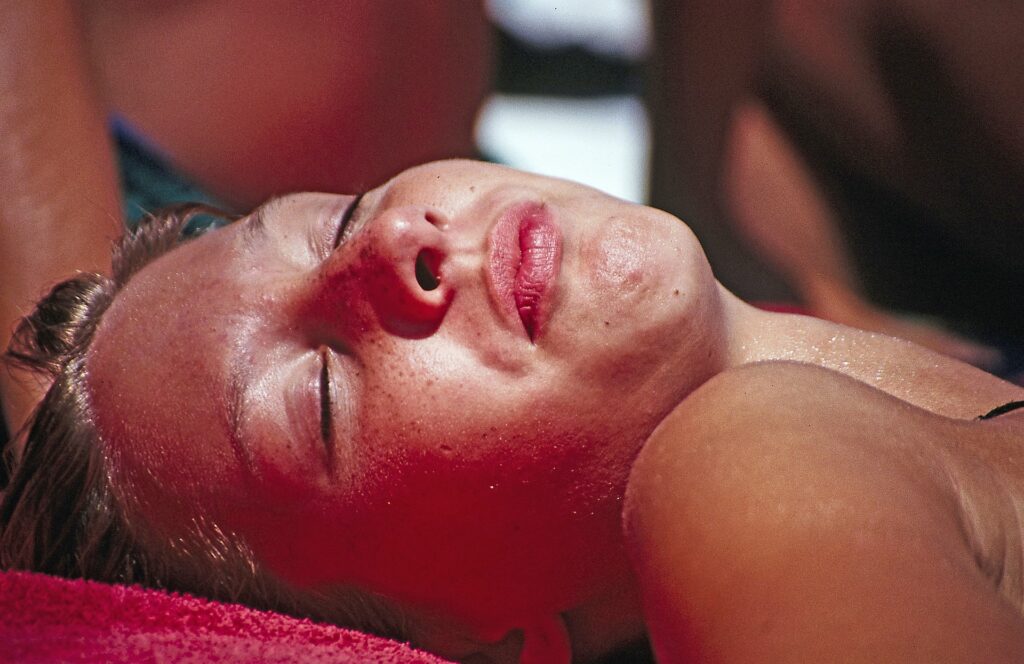 Woman sunbathing outdoors with visible facial redness from prolonged sun exposure.