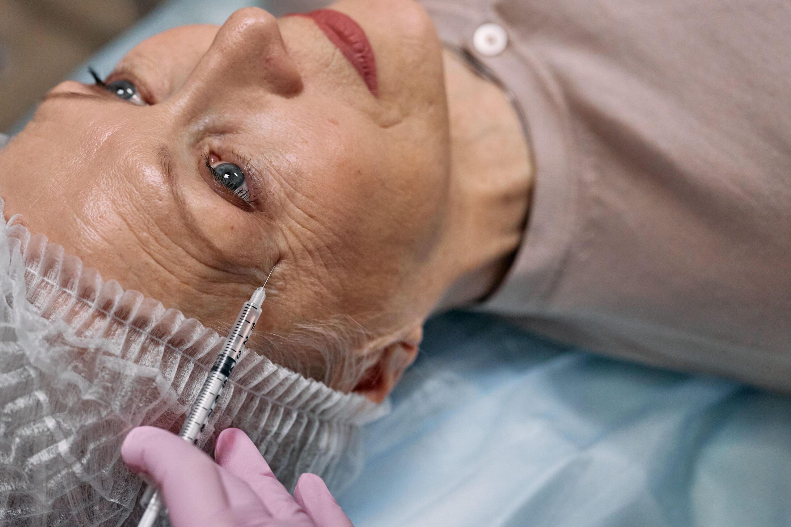 Medical professional administering Botox injections to reduce crow's feet and fine lines around the eyes.