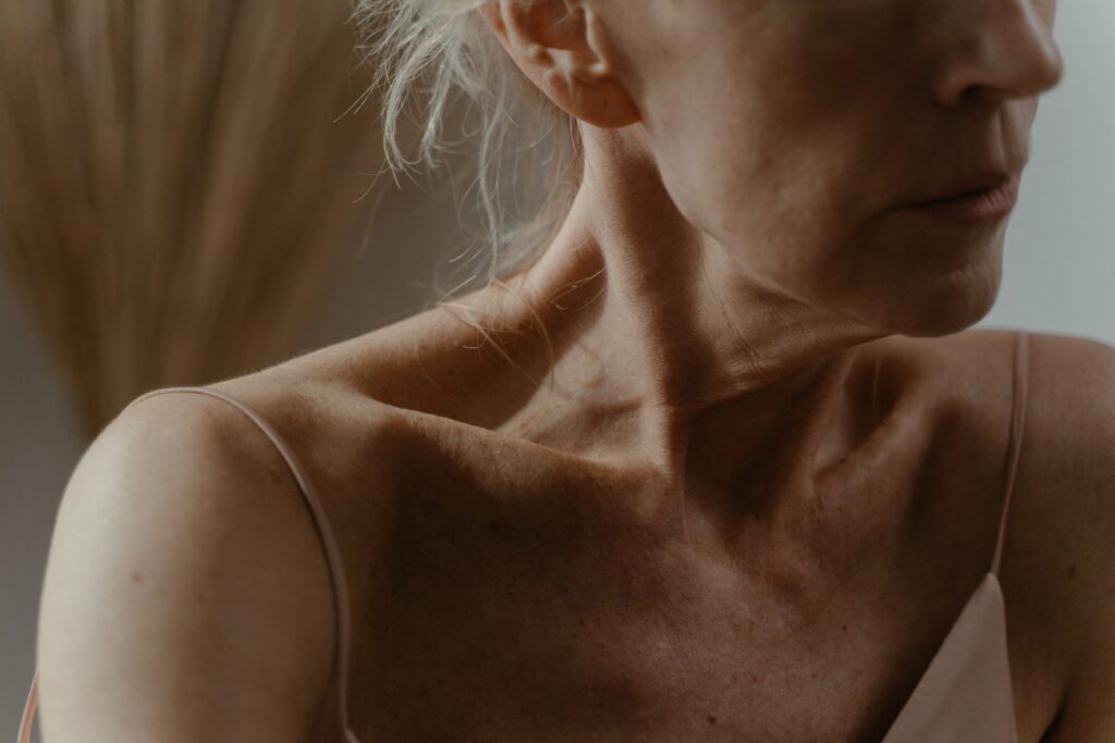 Close-up of mature neck skin showing visible laxity, lines, and age-related changes.
